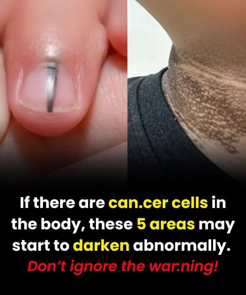 If There Are Can:cer Cells in the Bo:dy, These 5 Areas May Start to Darken Abnormally