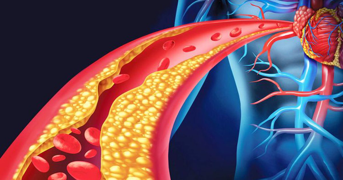 Kolesteroli dhe trigliceridet: Si t’i ulni në mënyrë natyrale dhe të mbroni zemrën tuaj